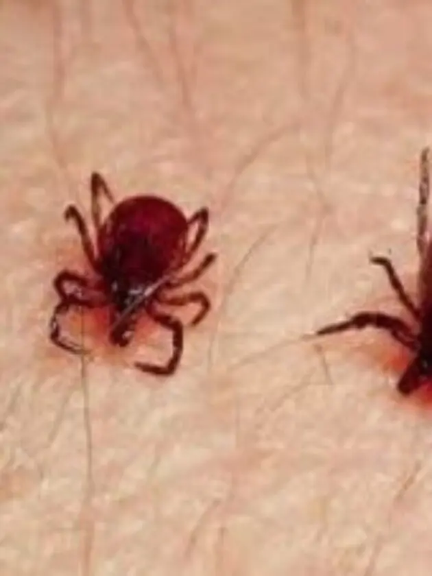 scrub typhus