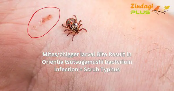 Scrub Typhus, Bacterial Infection, Skin Patches, scrub typhus symptoms